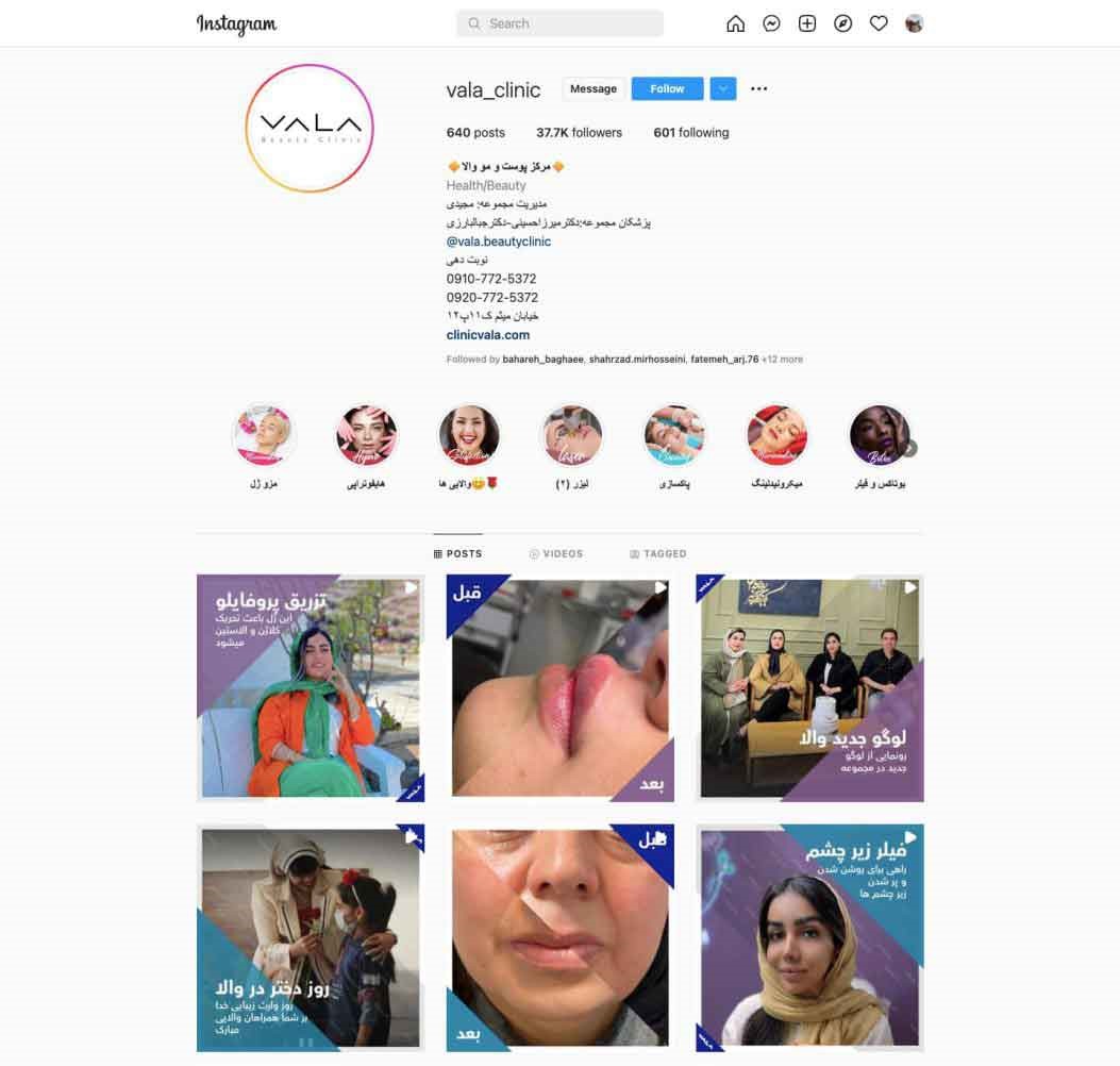 Instagram page management, design and upload for beauty clinic (vala clinic)